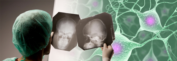 Riabilitazione specialistica Neuromotoria FERB